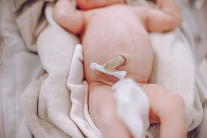 newborn umbilical cord stk