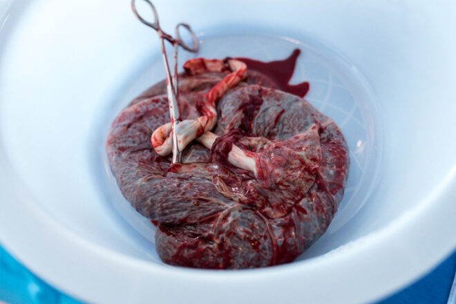 Placenta in a blue bowl