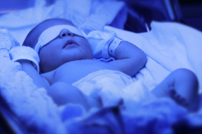 Jaundice in Newborns UV Lights