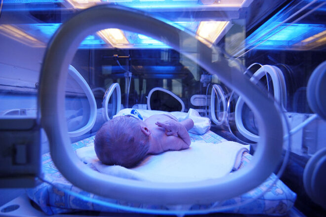 Jaundice Baby in UV lights
