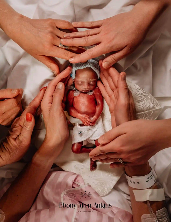 Stillborn being cradled by mother and fathers hands