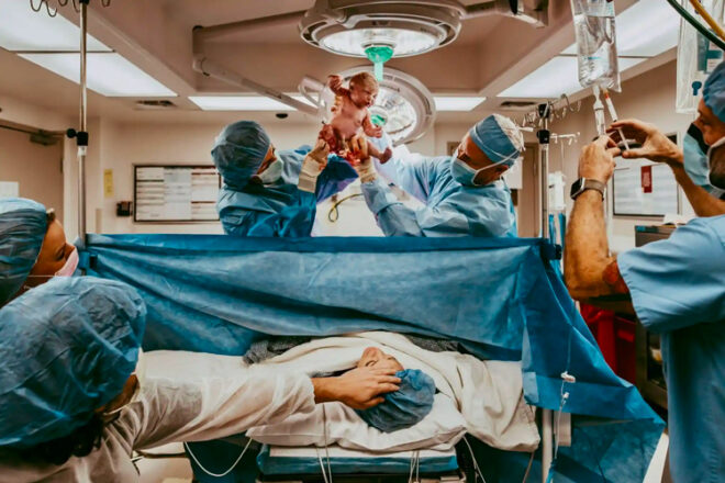 C-section delivery with doctor holding up baby to show mum over the curtain