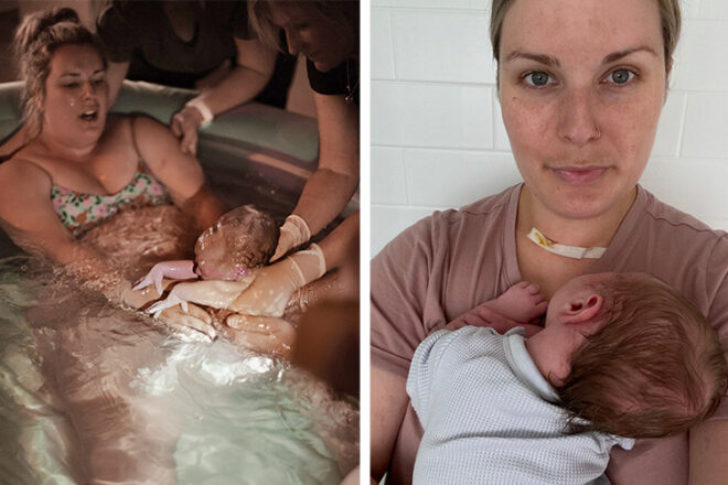 Kate gives birth in a water pool, and Kate holds her newborn after surgery.