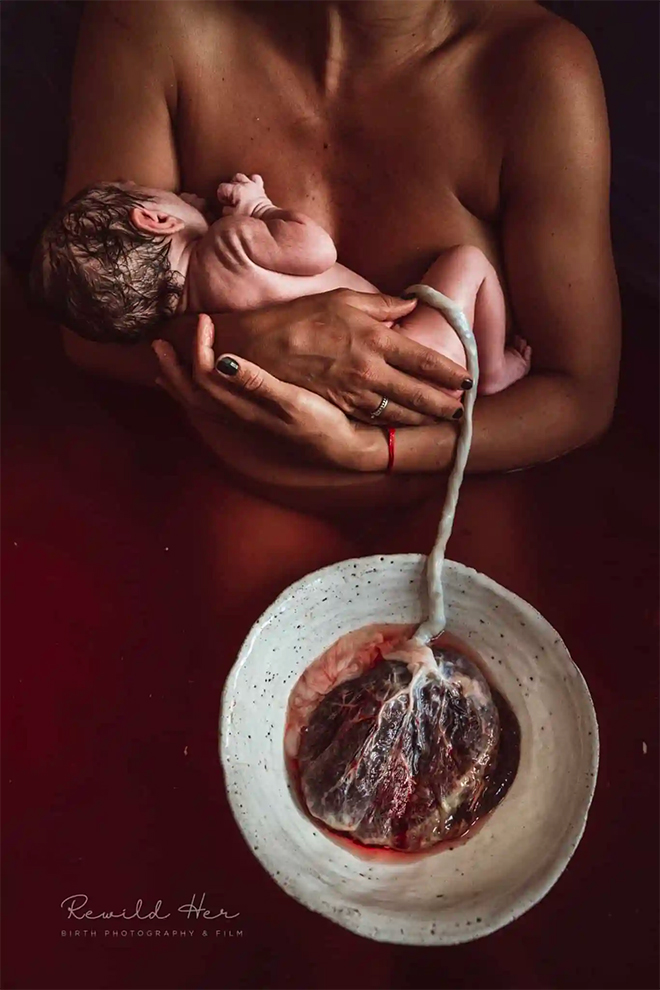 mother holding newborn still attached to the Placenta 