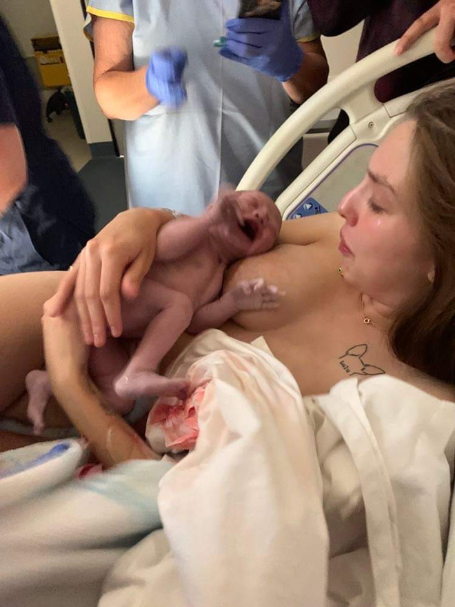 Ruby after giving birth being passed her baby