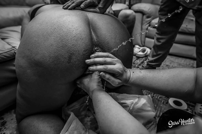 Birth photograph with midwifes hands on the babies head and fluid leaking