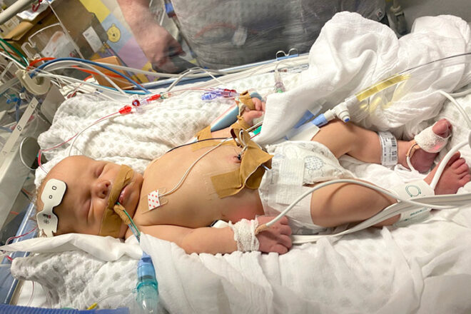 Baby Matthew in hospital hooked up to IV lines and breathing support.
