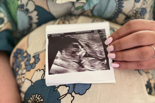 Emily holding baby Charli's ultrasound photo
