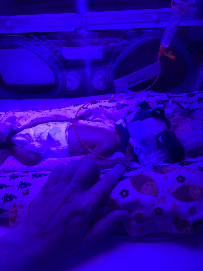 Baby Daphnie under ultra blue light
