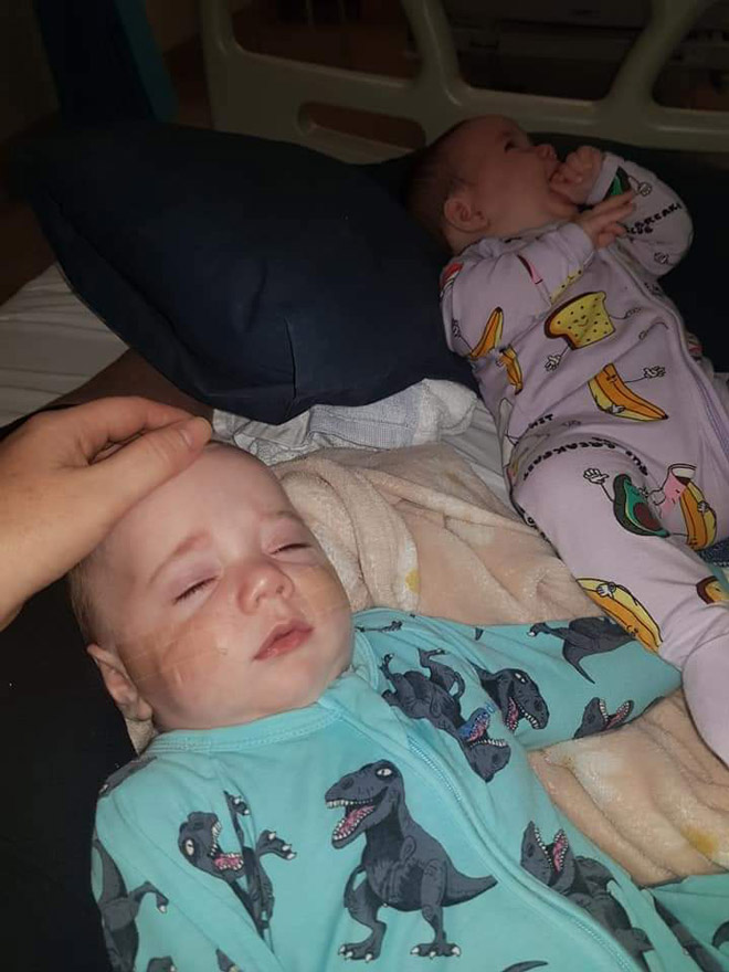 Twins sick with RSV