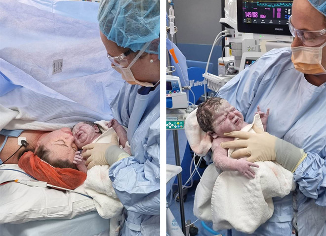 Stacy delivers her third baby via c-section