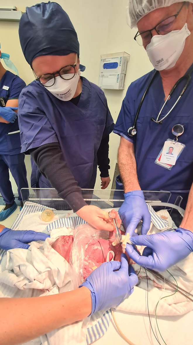 Midwives cut the umbilical cord of one of the triplets.