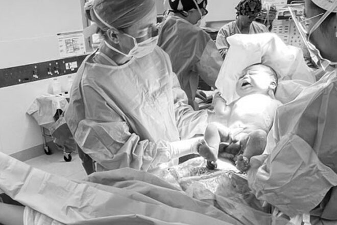Avery, the 6kg newborn being born by c-section