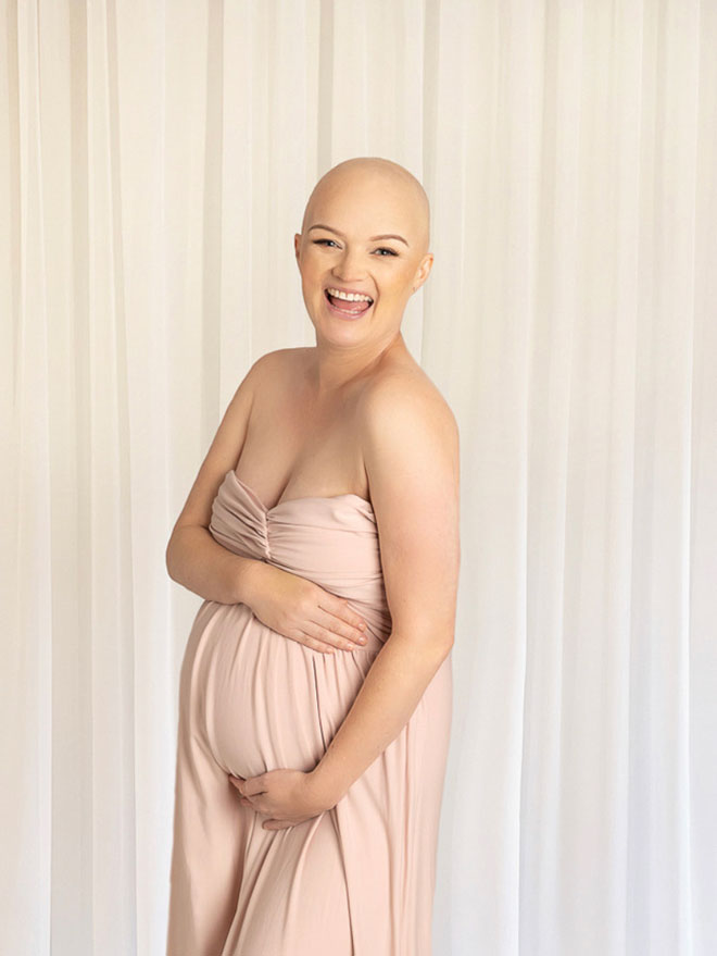 A pregnancy photoshoot, Alana shows off her belly with a bald head from chemotherapy