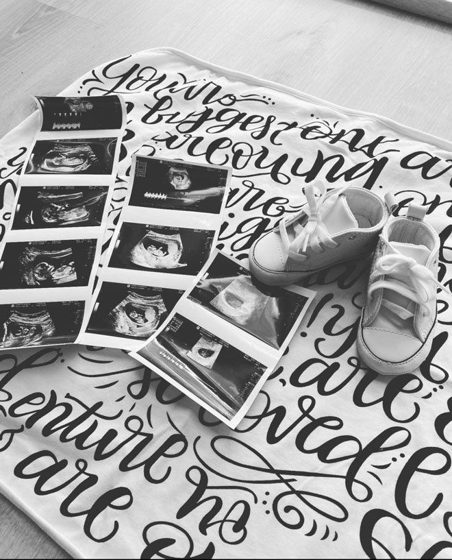 Pregnancy announcement with ultrasound photos and little shoes