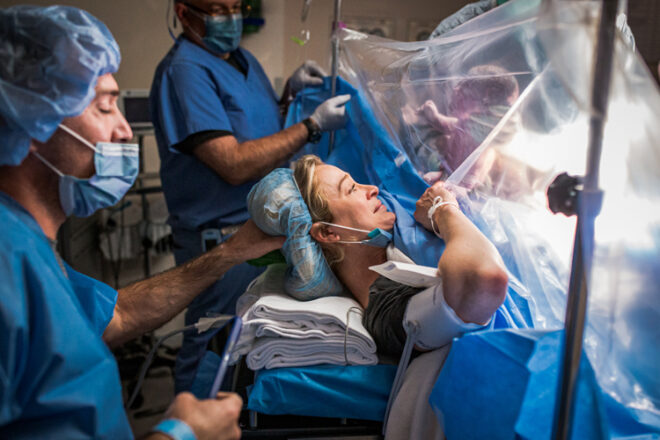 A woman on an operating table looking through a plastic sheet