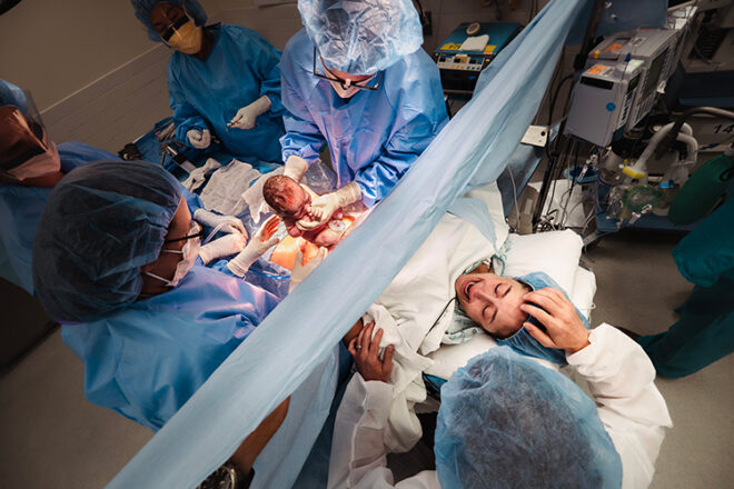 A woman in active birth undergoing a cesarean surgery