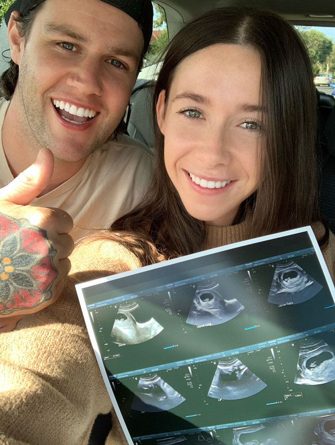 Jacki and Luke with an ultrasound photo