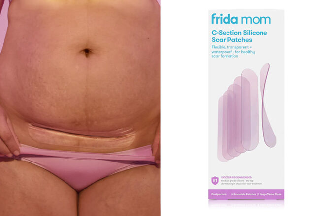 Frida Mom Silicone Strips showing a woman wearing the strip over her scar beside brand packaging.