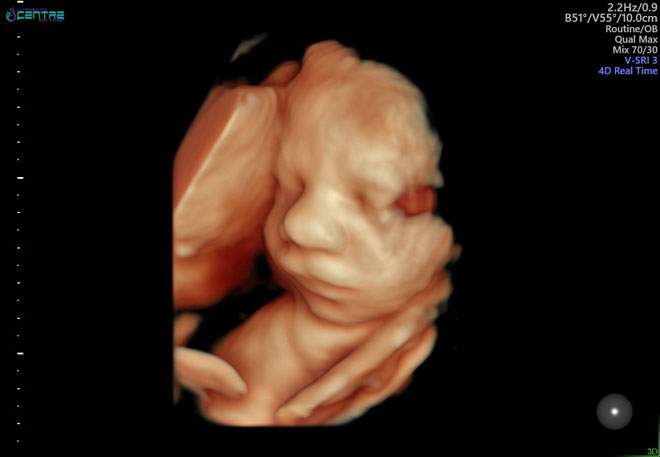 A 4D scan of baby