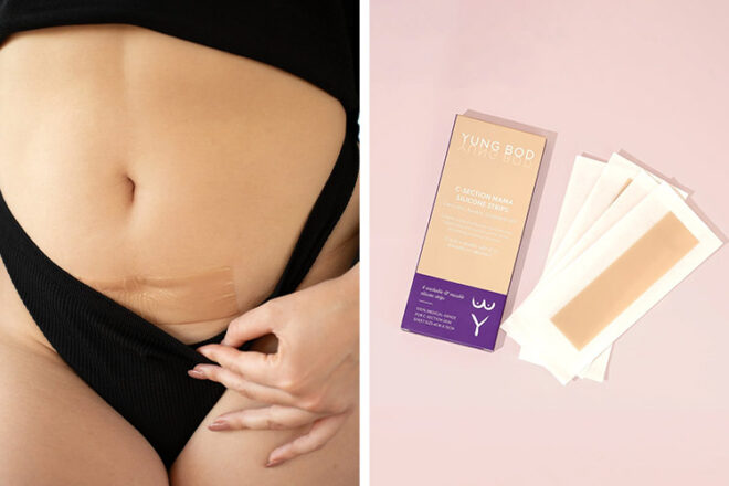 Yungbod C-section Silicone Strips showing the strips attached to a woman's belly showing size and colour alongside brand packaging