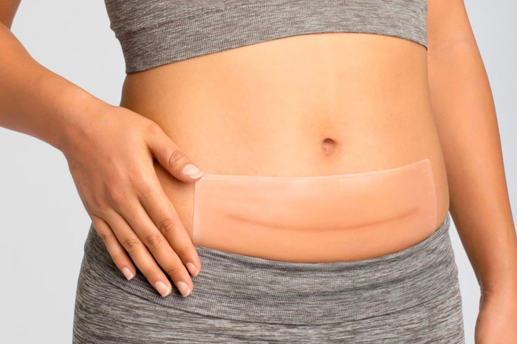  Tummy Tuck Post Surgery Supplies Kit - Silicone Scar