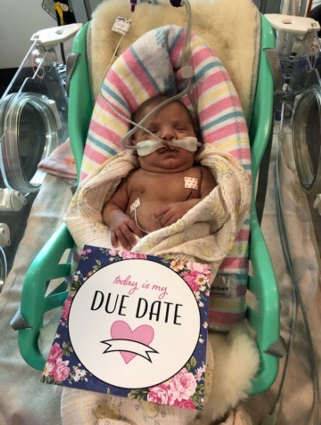 Baby Andie in hospital on with a due date card
