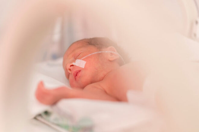 A newborn baby with an oxygen tube under their nose