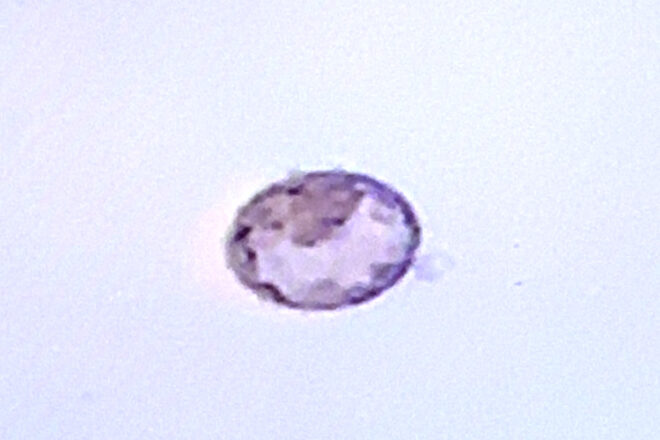 Close up of fertilised embryo