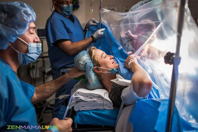 A woman seeing her baby she just birthed via Caesarean through the plastic sheet in the operating room